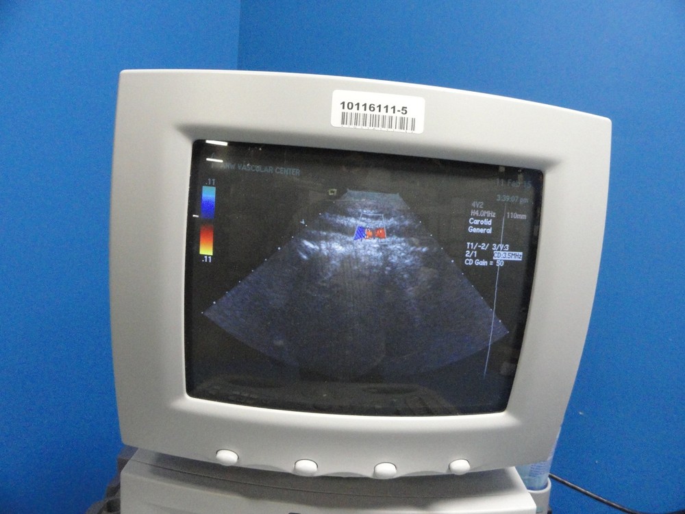 Siemens Acuson 4V2 Vector Array Ultrasound Transducer/Probe W/ Case ~ 8592