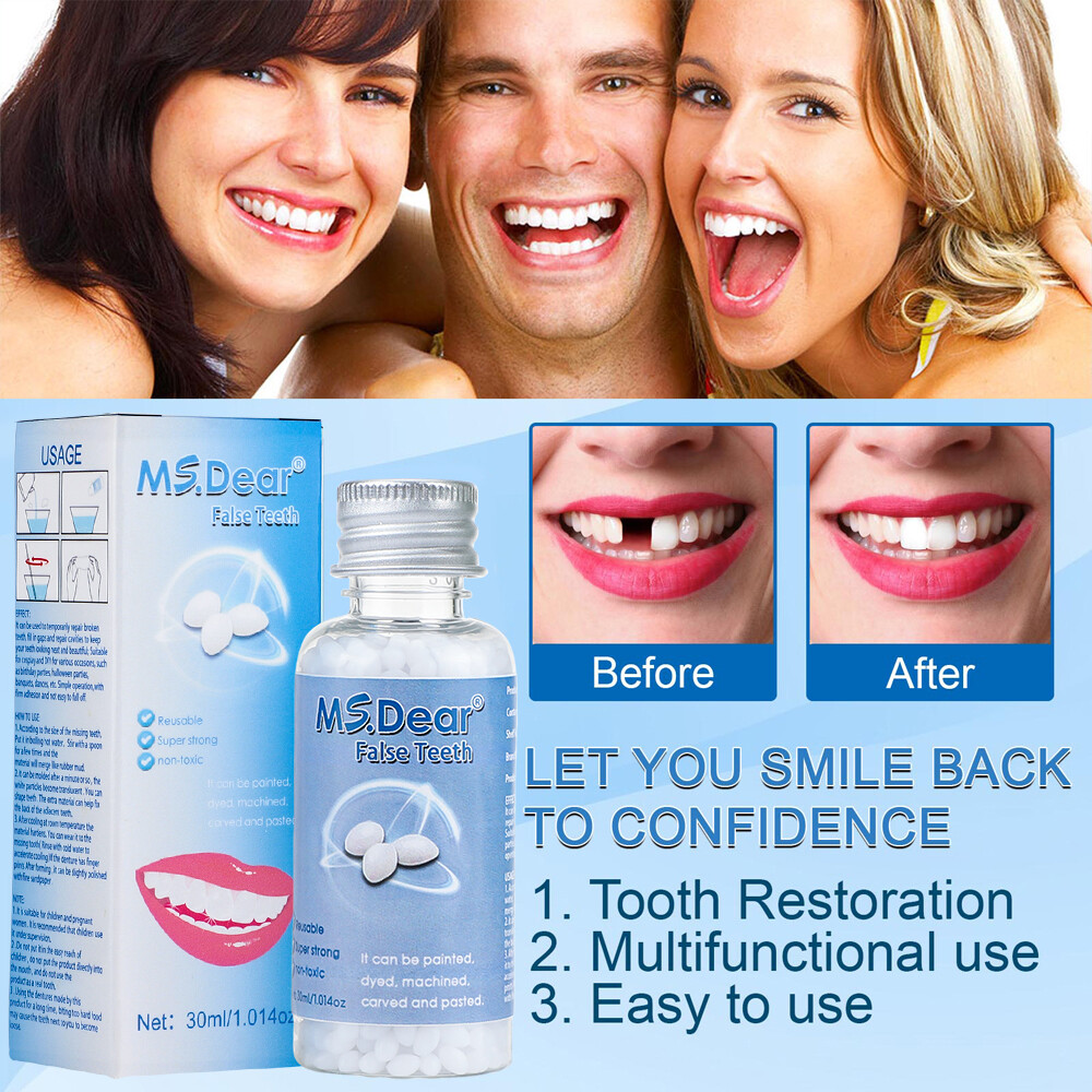 Temporary Tooth Repair Kit Temp Dental Repair Replace Missing Teeth DIY Moldable