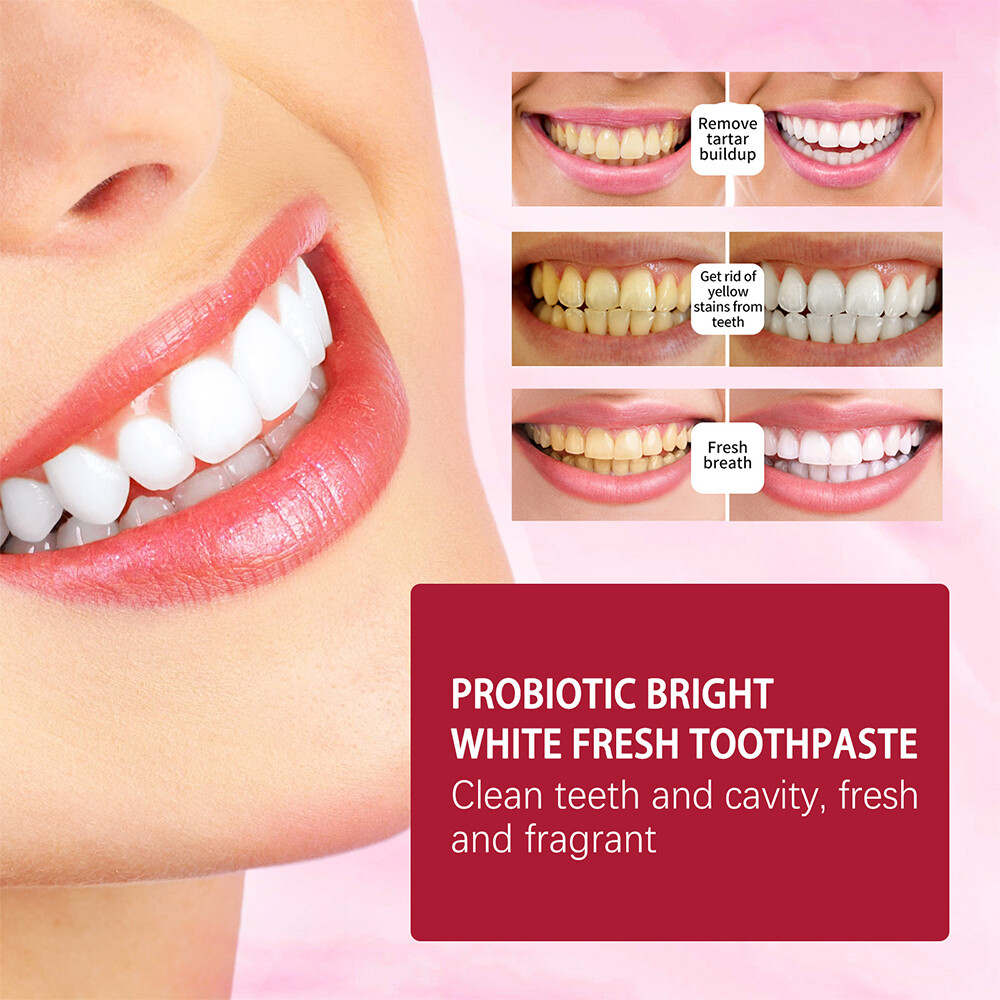 Sp-4 Probiotic Toothpaste for Whitening Bleaching Teeth Stain Removal Cleaning
