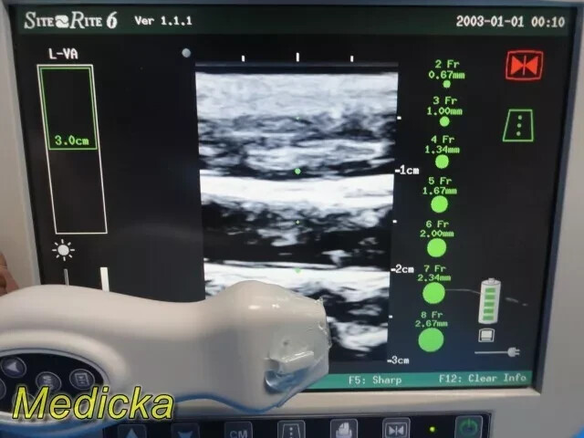 Chison Tech L-VA Linear Array Probe – Vascular Imaging for SR-6 (Tested) ~ 36100