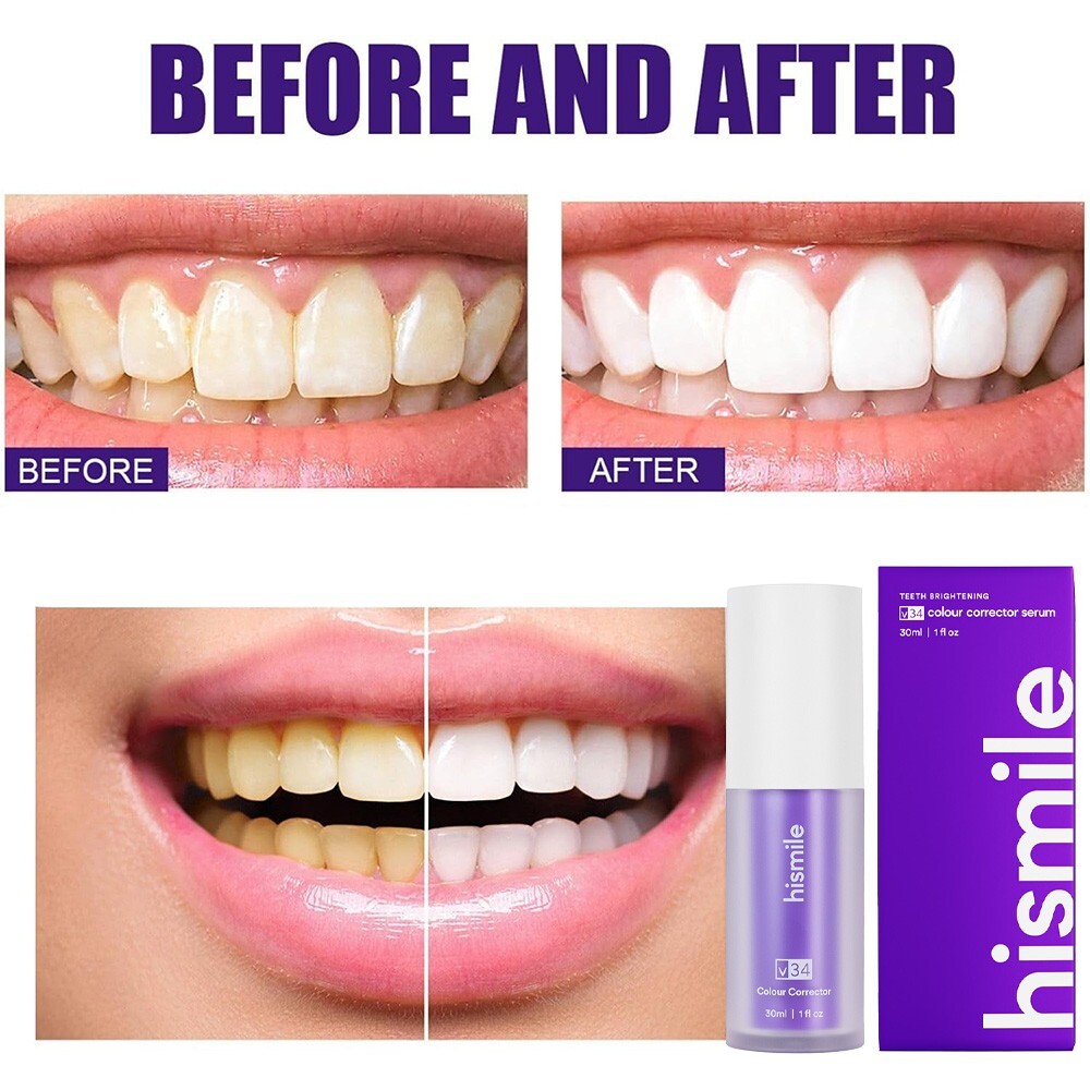Hismile V34 Colour Corrector - Purple Teeth Whitening for Tooth Stain Removal