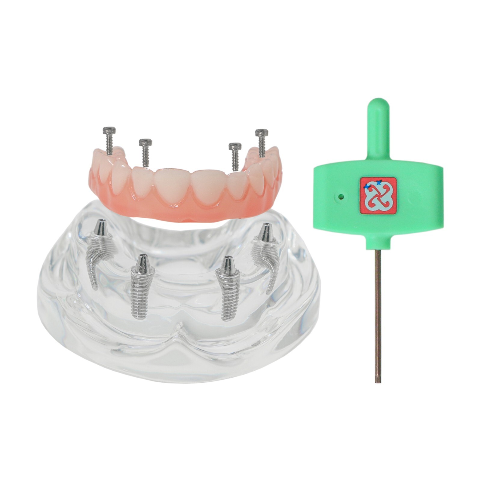 All-on-4/6 Dental Implant Model Upper/Lower Jaw Removable Screws Transparent