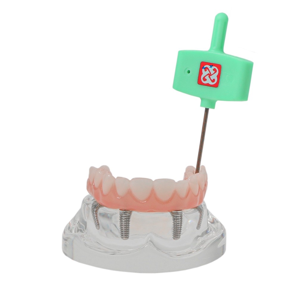 Dental Implant Disease Teeth Model Overdenture Implants Upper/Lower Demo