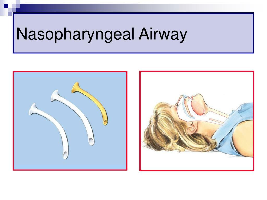 IFAK, Trauma Kit, First Aid, Quick Clot, Blow out kit, 13+ items, SHIPPED FREE