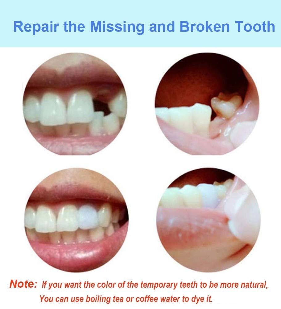 Tooth Filling Thermal Beads Do it Yourself Moldable False Teeth for Temporary...