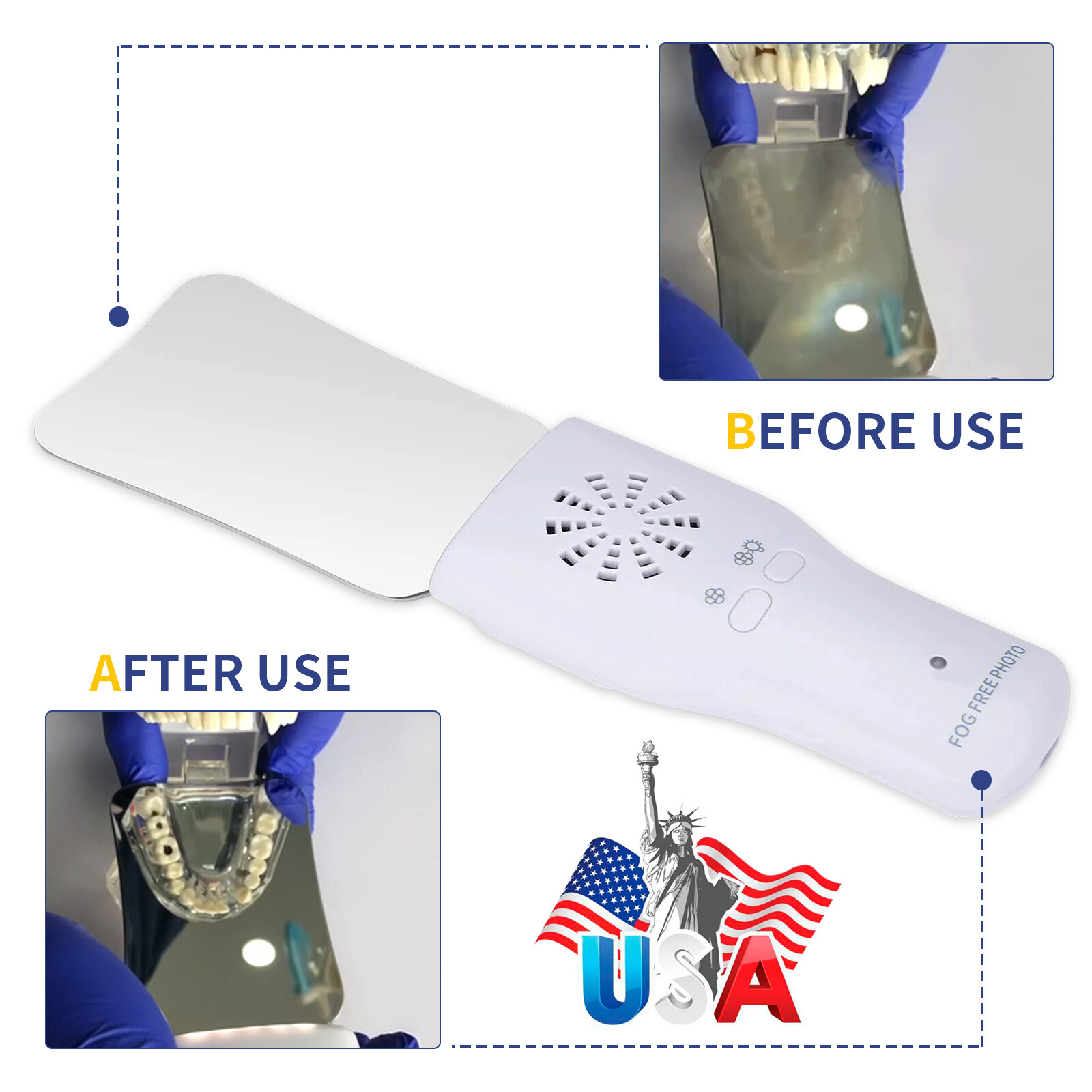 Dental Occlusal Mirror Fog Free LED Intra Oral Photo System 4 Mirror Anti-Fog JZ