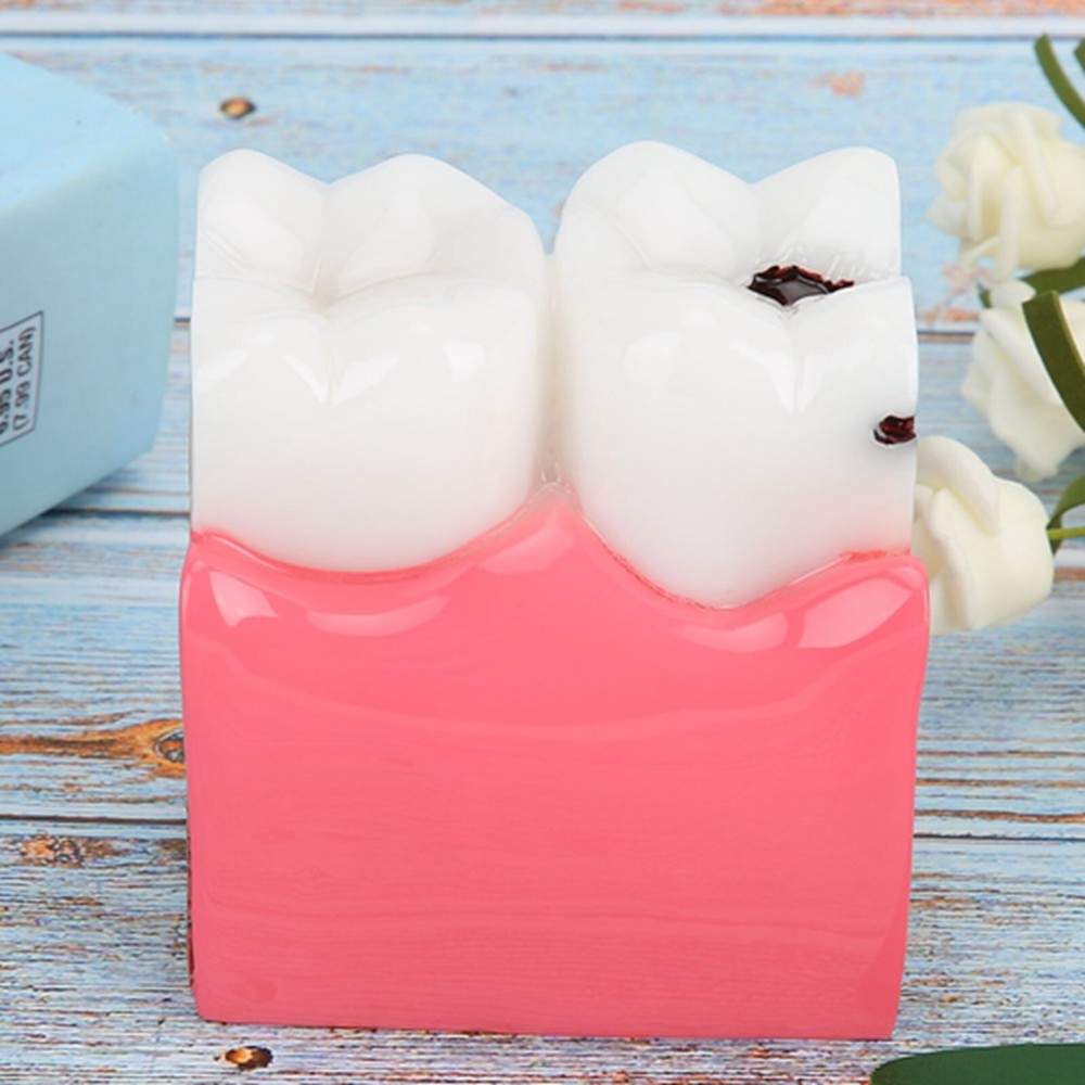 Caries Comparison Study Models Dentist Dental Anatomy Education Teeth Model