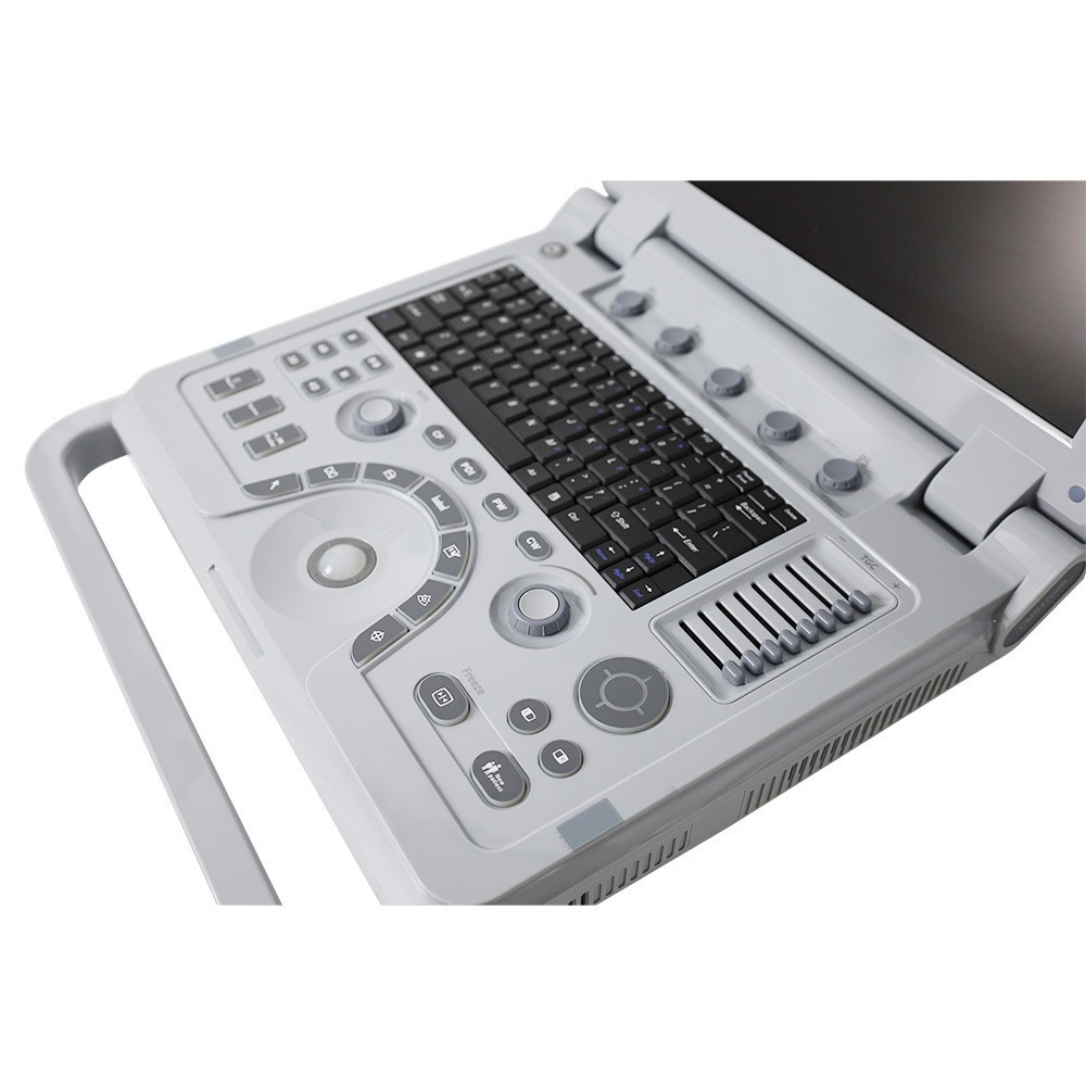 Portable Color Doppler Ultrasound Scanner Machine DiagnosticSystem Convex Linear