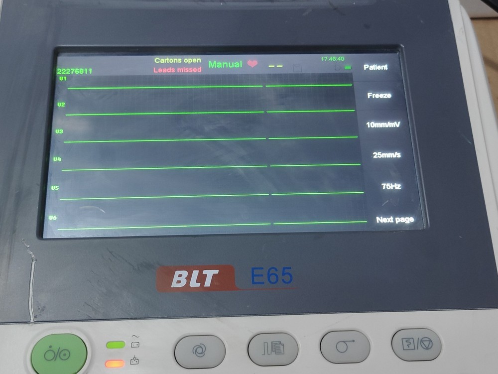 electrocardiograph Digital Biolight E65 ECG Machine 12 Channel ECG Machine