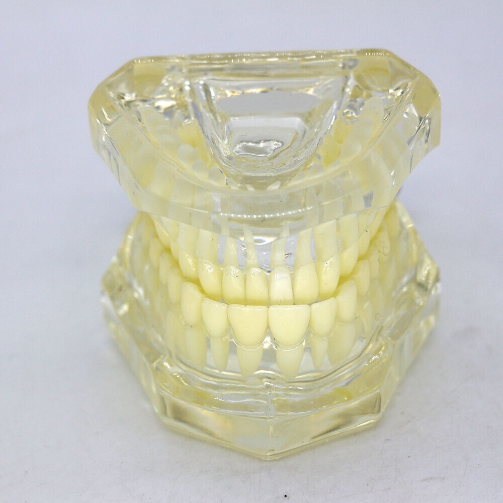 1×Transparent Plastic Study Teeth Model Demonstrate Comprehensive Repair Yellow