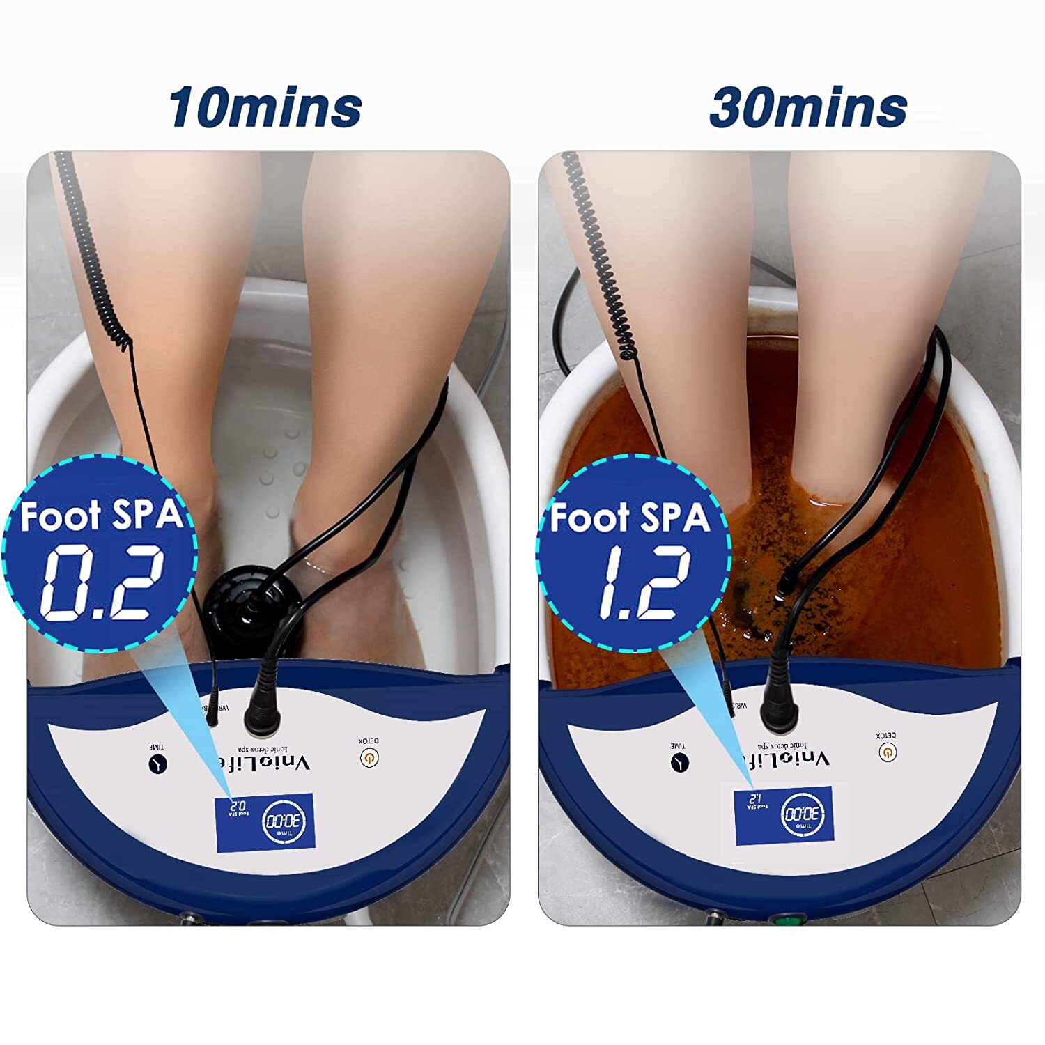 Ionic Foot Spa Bath Detox All-in-One Machine 2023 Ion Heavy Metal Detox System