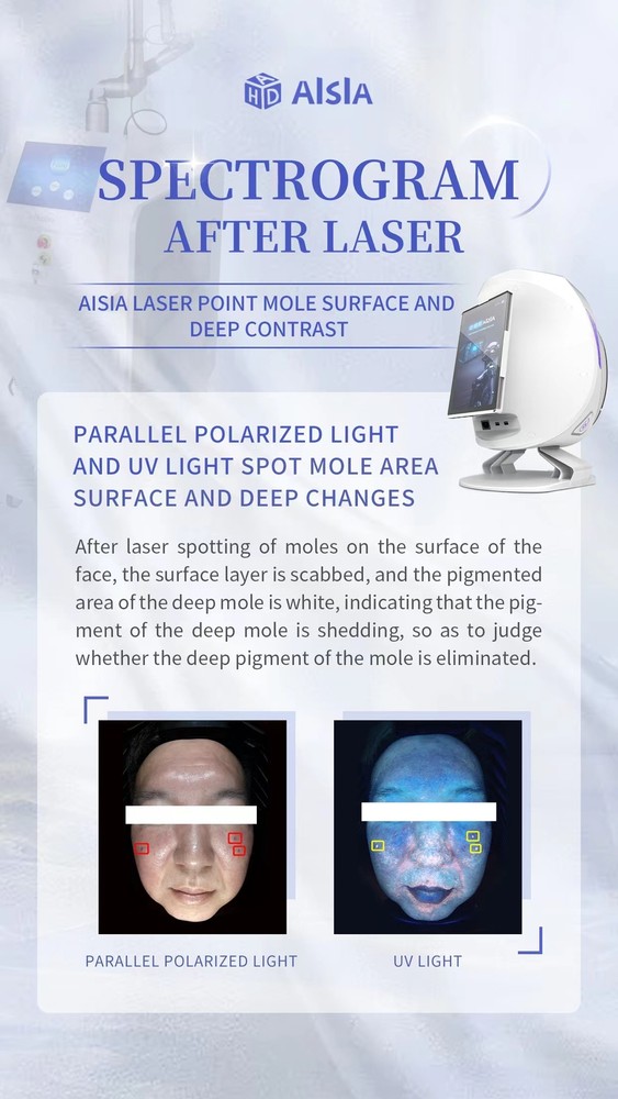 Portable Smart 3D Scanner Camera Device Facial Test Skin Analyzer Machine