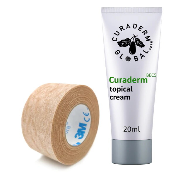 Curaderm BEC5 Cream and FREE 3M Micropore Tape with FREE Shipping inside U.S.