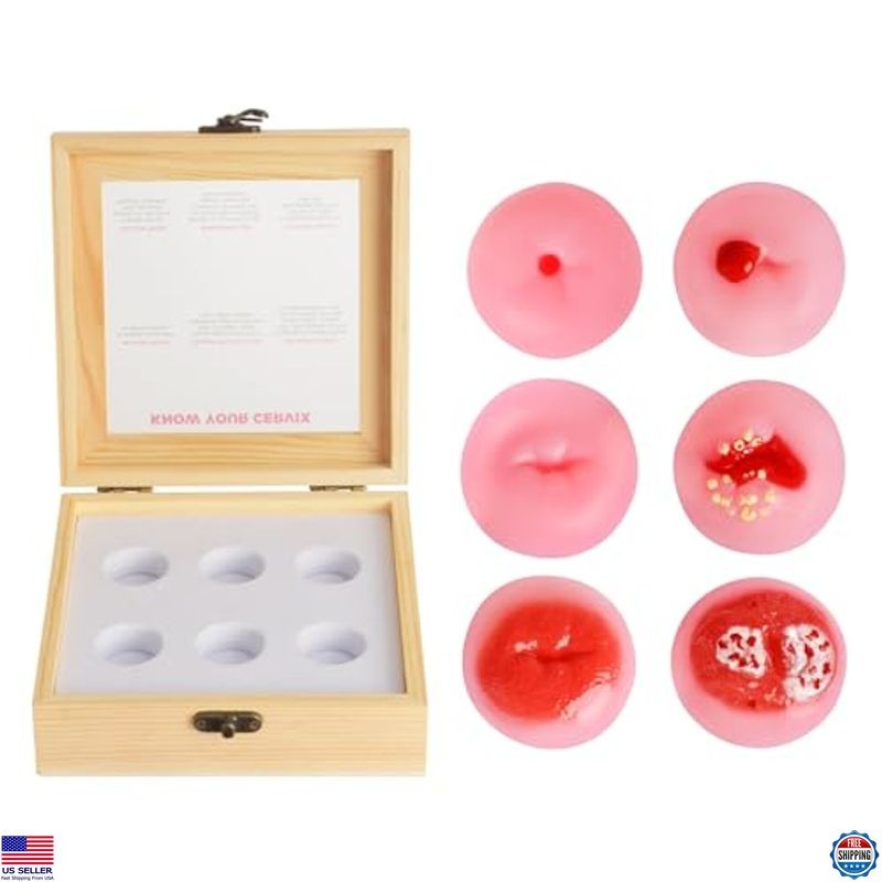 SimCoach Cervical Pathology Model Set - 6 Realistic Cervix Replicas for Training