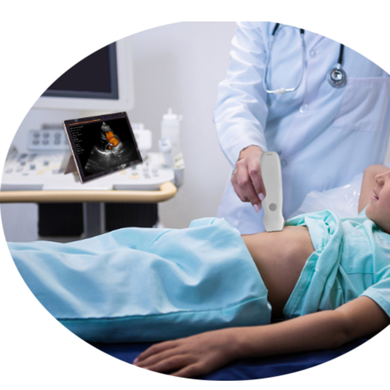 Color Wireless Ultrasound Doppler Phased Array Cardiac Probe Include CW Mode