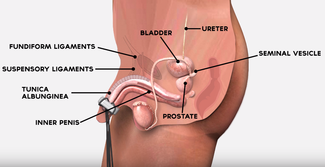 Penis Stretching Device - Male Enhancement Penis Stretcher - Fits all Sized Men