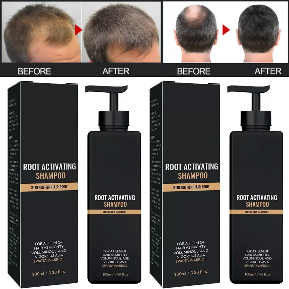 1-3PCS Root Activator Shampoo, SPARTAN Hair Loss Shampoo,Shampoo Root Activator