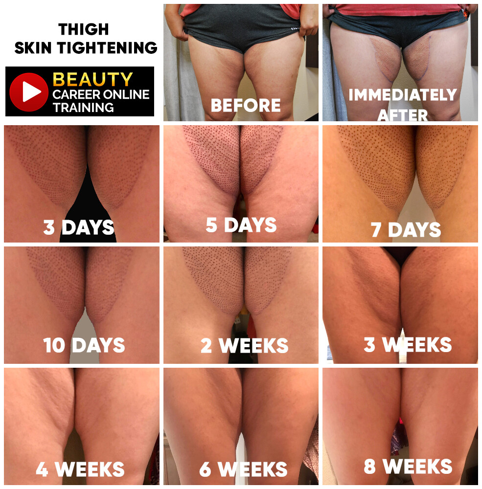 Beauty Career Wrinkle Reducing Complete Online Training Certification Course