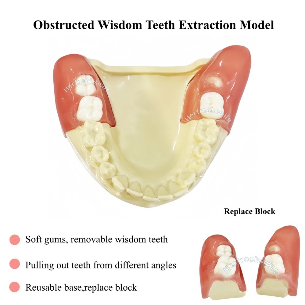 Dental Obstructed Wisdom Teeth Extraction Model Lower Soft Gingiva Study Model