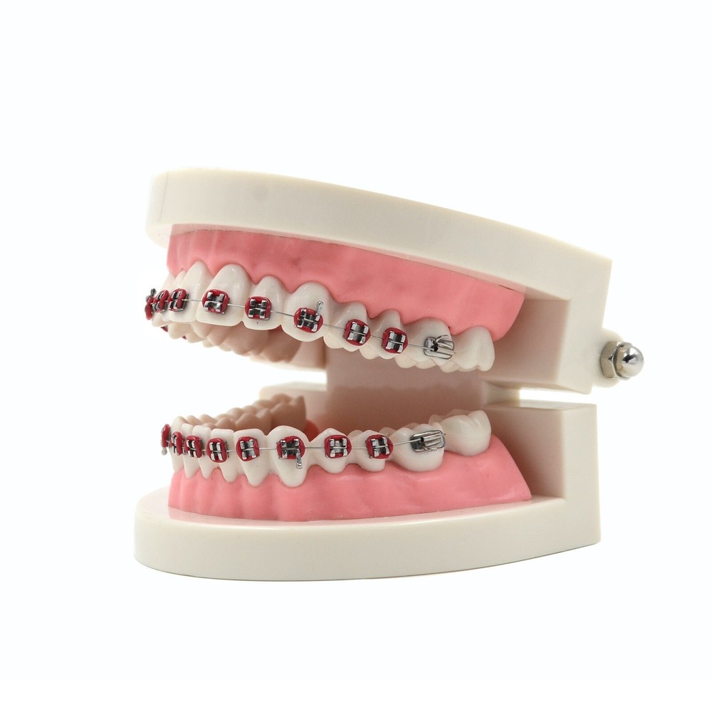 Dental Teach Typodont Demonstration Teeth Model with Braces For Patient Study