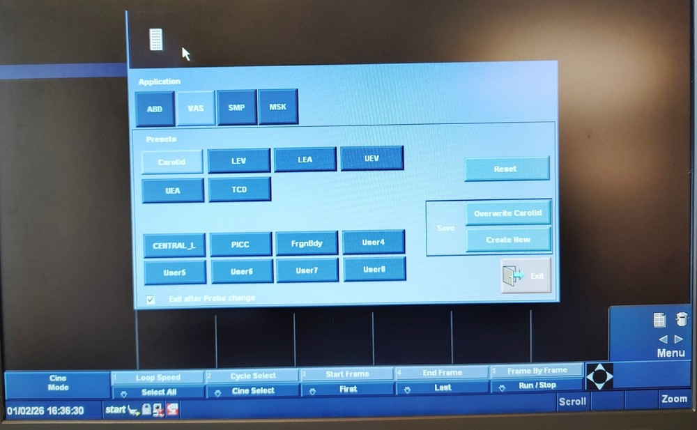 GE LOGIQ E Ultrasound System