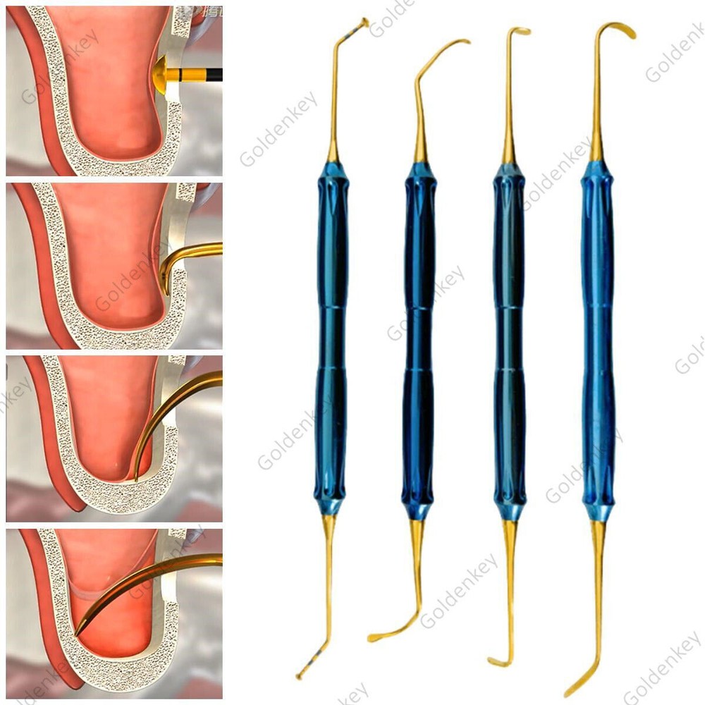 Dental Lift Handles DASK Sinus Tool Instruments 4Types Fits Den