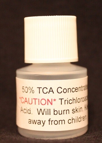 Fast Acting Wart Remover Plantar and Genital HPV Treatment Liquid Solution