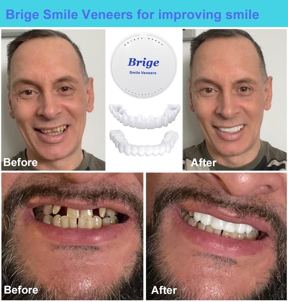 1 pair Temporary False Teeth Set – Natural-Looking Smile Enhancer for Confidence