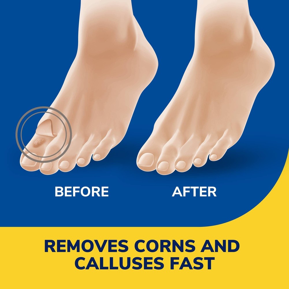 Liquid Corn & Callus Remover, 0.33 Ounce 4 Piece Set, Multicolor