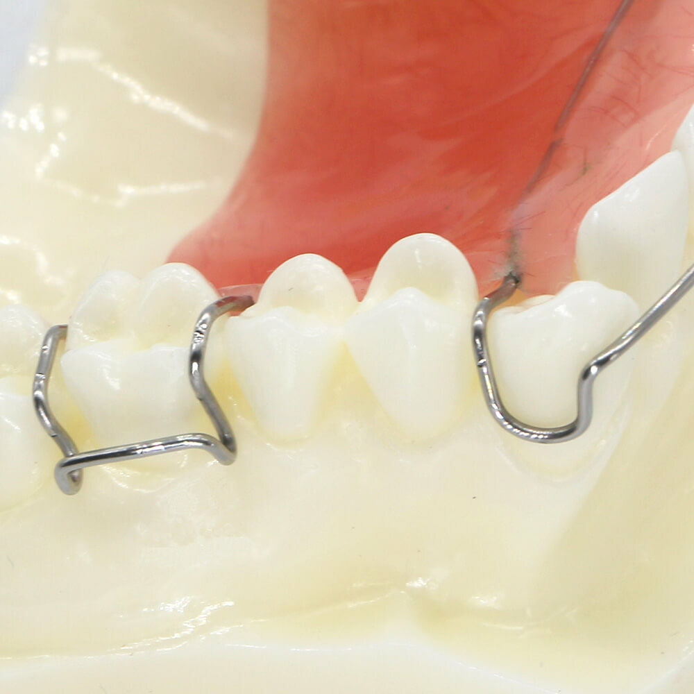 Dental Orthodontic Wearing Trainer Demonstration Plastic Model Teeth