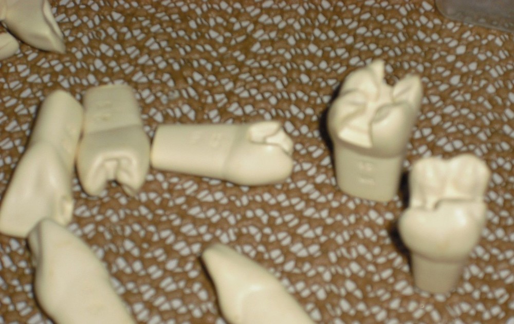 Dental Teeth Preparations for Students and Practicioners - Assorted Preps