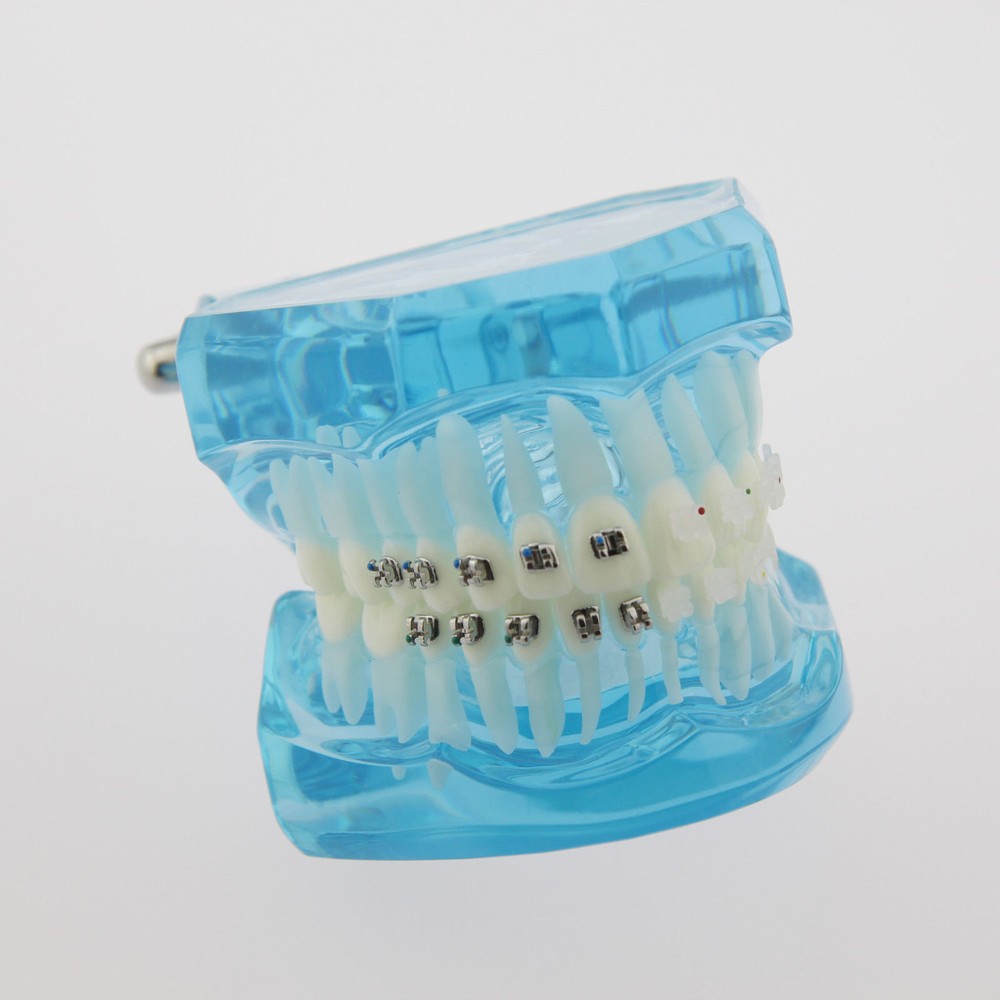 Dental Teach Study Typodont Teeth Model Half Metal Bracket Half Ceramic Bracket
