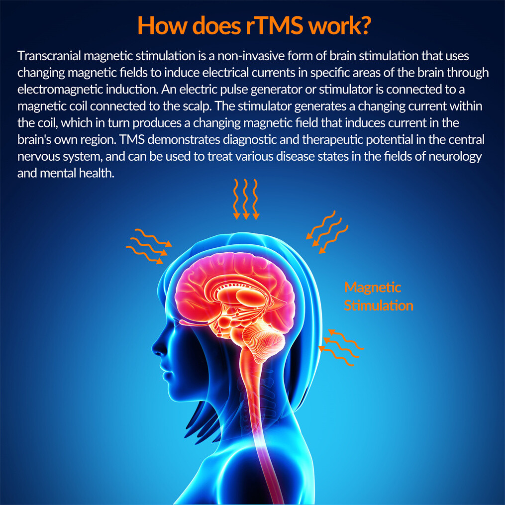 TMS Therapy Device for Brain Stimulation & Mental Wellness Support and Stroke