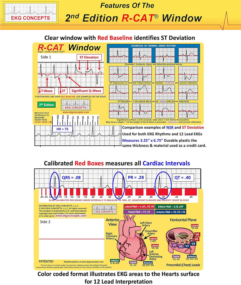 EKG Window: Second Edition