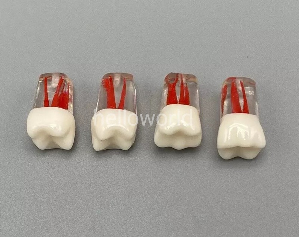 Dental Root Canal Teeth Study Practice Model Endodontic RCT Endo Pulp File 5pcs