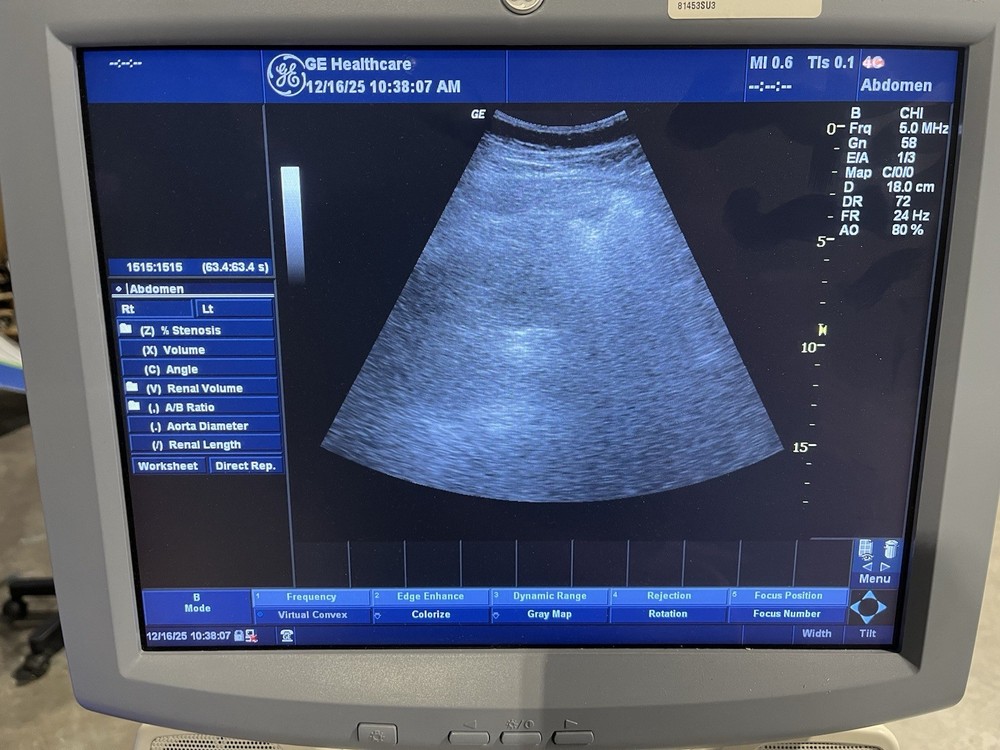 GE 4C Convex Array Ultrasound Transducer Probe -