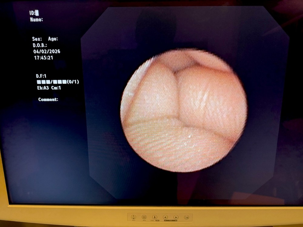 BF-MP190F Endoscope /Video Scope