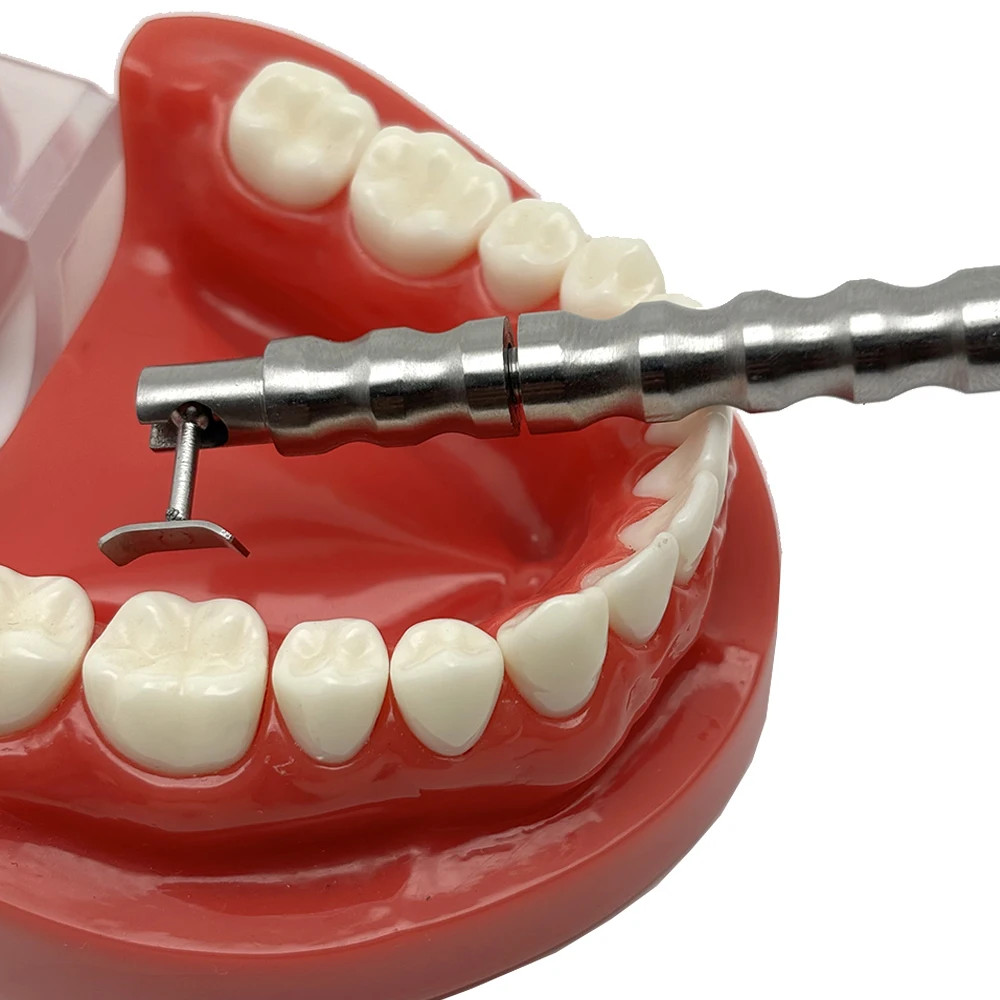 Dental Implant Gingival Protecting Socket Shield Retractor Protector Gum Separat