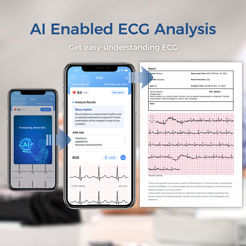 ECG EKG Monitor 30s/60s/5min Recording AI-ECG Analysis Report in App PC Software
