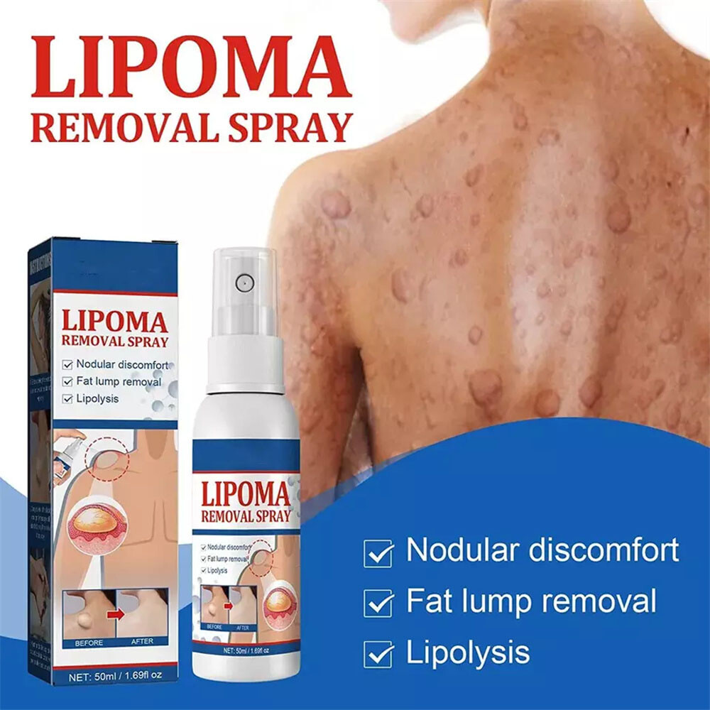 50ML Lipomheilung Reduction Spray, Instant LumpFree Lipoma Removal Spray