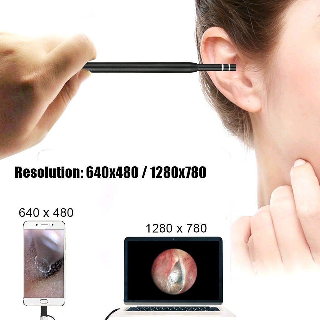 LED Ear Endoscope HD Otoscope Ear Wax Removal Cleaner Tool Camera Kit