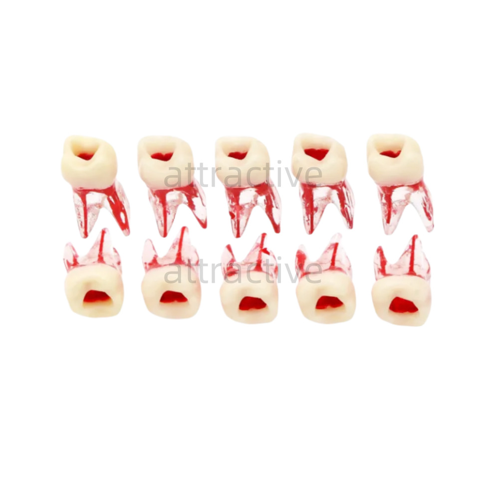 Dental Tooth Endo Root Canal Study Model For RCT Practice Blocks Pulp Cavity