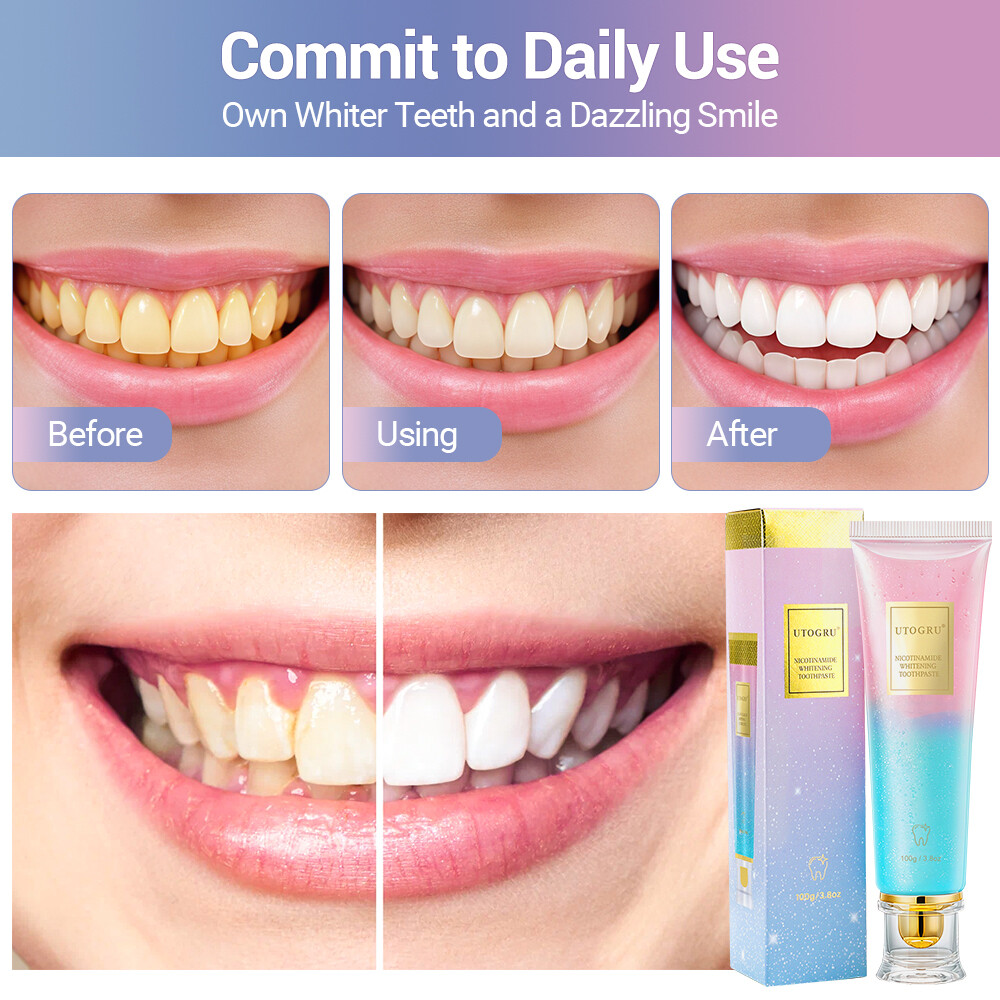 Niacinamide Toothpaste Effectively Whitens Teeth &Stains From Remove Oral Clean