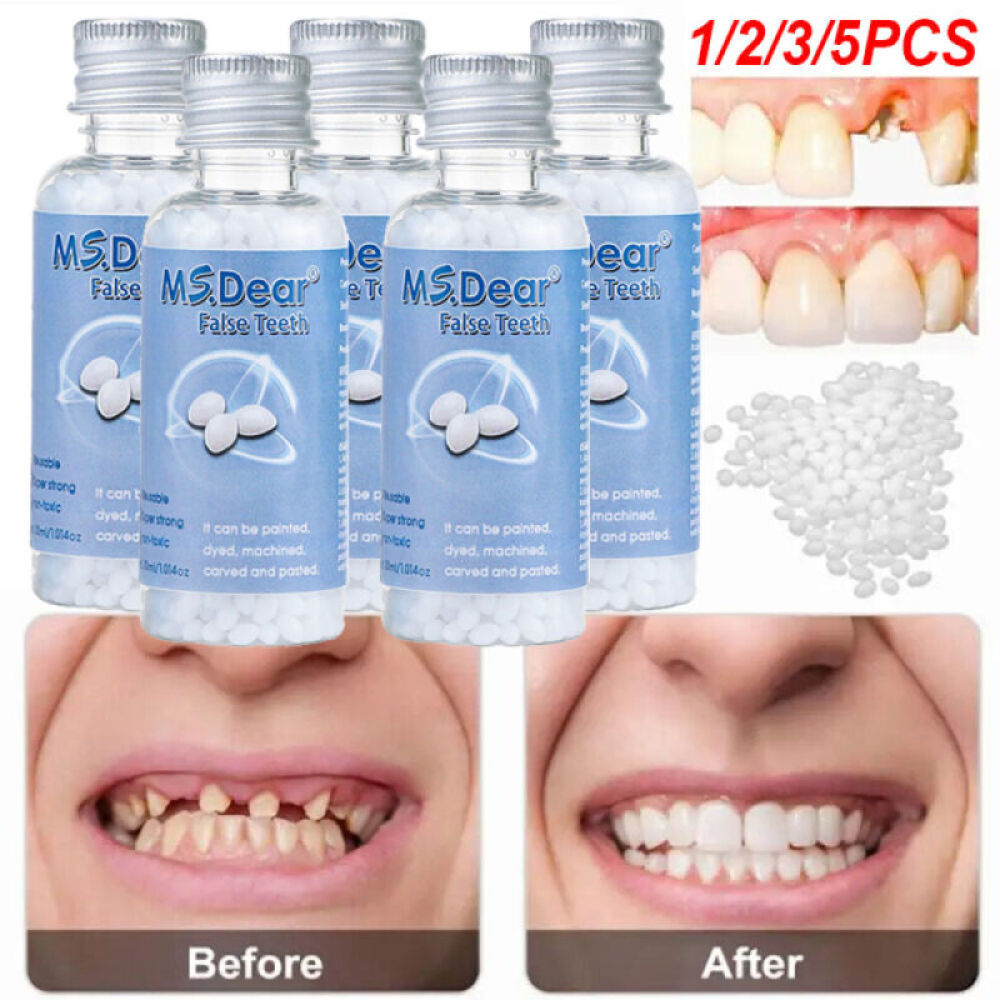 Tooth Repair Kit - Temporary Teeth Replacement Kit for Missing & Broken Teeth US