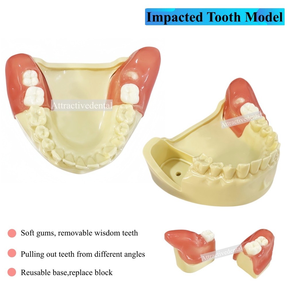 Dental Obstructed Wisdom Teeth Extraction Model Lower Soft Gingiva Study Model