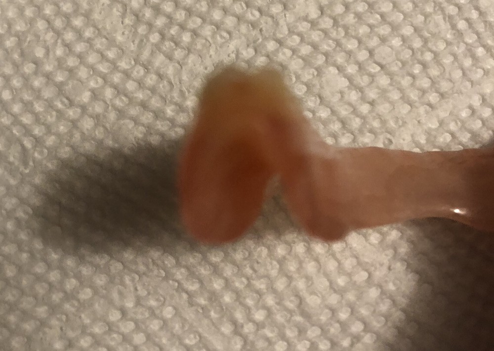 BURBANK Replacement DentalLab Partials Lower Side 6 teeth CustomMadeMissingTooth