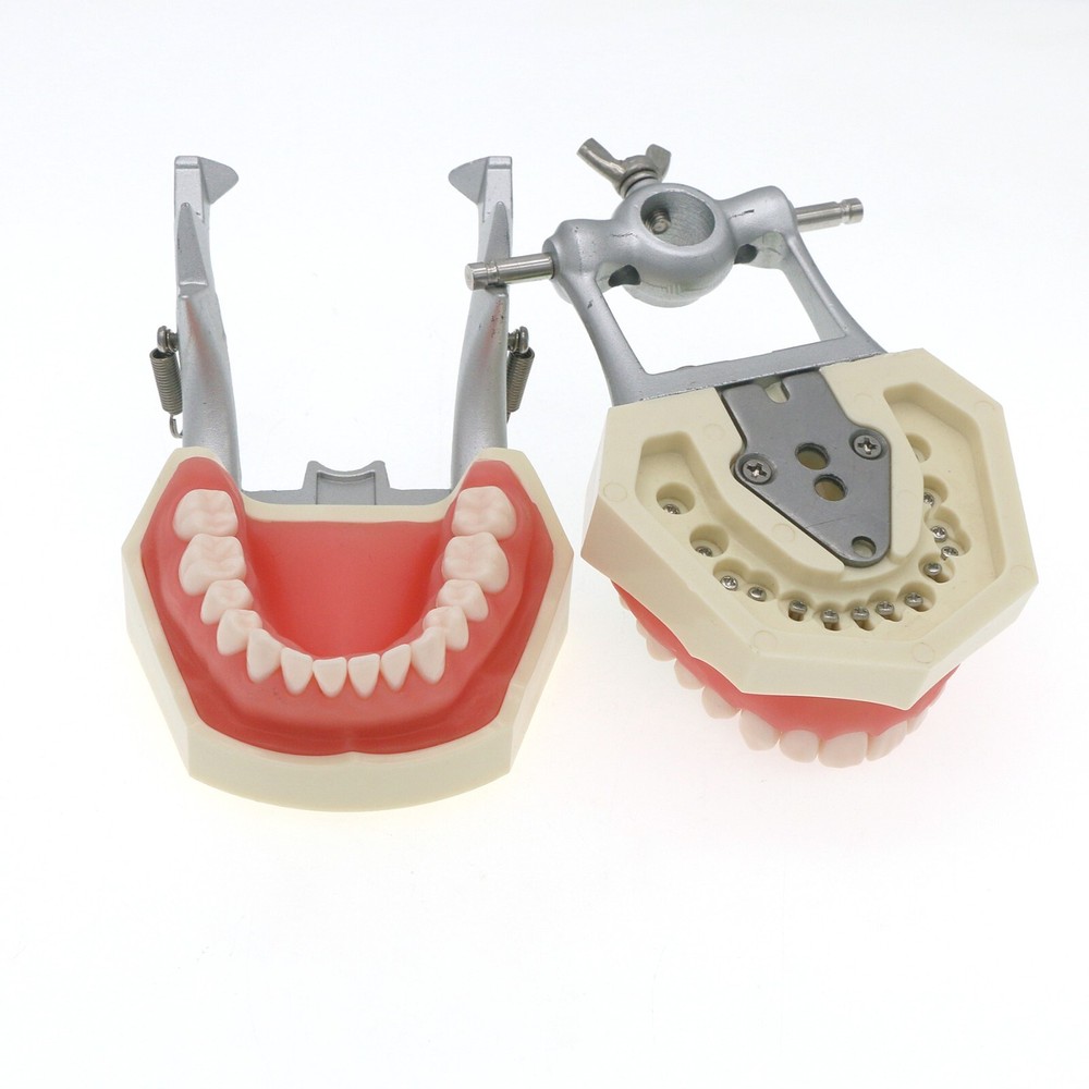 Dental Teeth Model Kit w/ Replaceable Teeth, Implant, Brackets, Mounting Pole