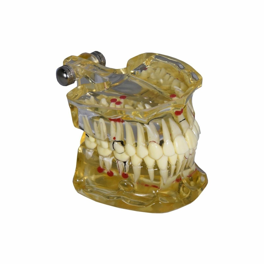 Redland Model Dental Demonstration Teeth Educational Model