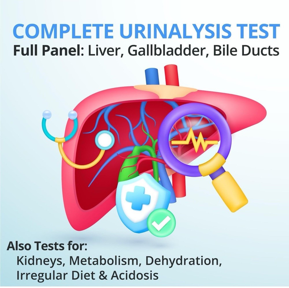 Urinalysis Liver Function Test Strips Full Panel 250 Strips Exp 10/24/2026