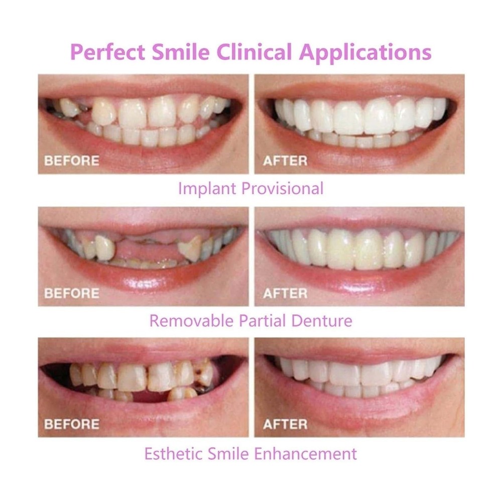 1 pair Temporary False Teeth Set – Natural-Looking Smile Enhancer for Confidence
